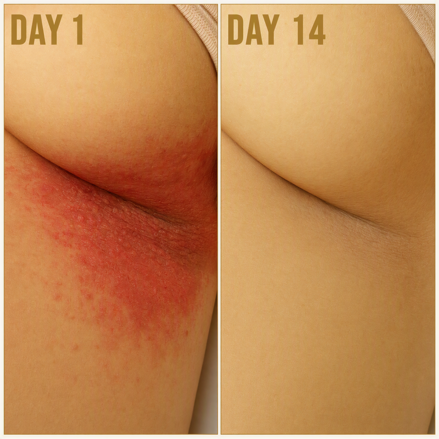Mycovera BioShield Soap